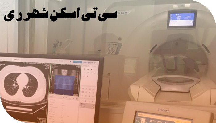 سی تی اسکن سی تی اسکن